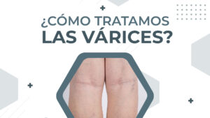 cirujano vascular buenos aires UQV - Unidades Quirúrgicas Vasculares. Cirugía Vascular. Flebología. Pie diabético. Tratamientos laser. Várices. Doctor Pardo